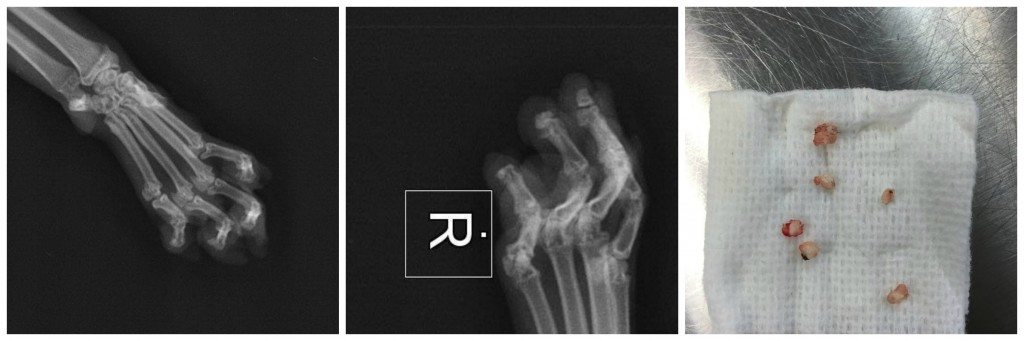 An x-ray taken before paw-repair surgery demonstrates the bony remnants seen on xray and the fragments removed after surgery. These toes, which were 'de-clawed', are riddled with scar tissue, the pads are thick, and the tendons are contracted so much that the cat has to change its gait to compensate. Paw repair surgery was performed by Montreal's Dr. Enid Stile (Sherwood Park Animal Hospital) and Dr. Gatineau (DMV) . 